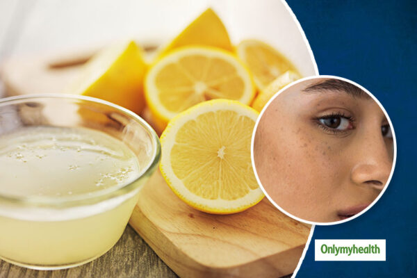 how to use lemon juice for dark spots