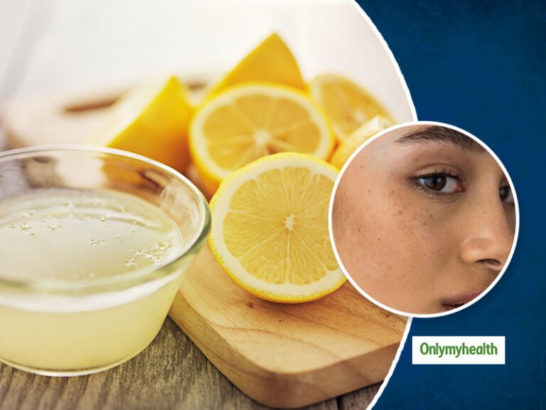 7 Ways how to Use Lemon Juice for Dark Spots Educated Valley