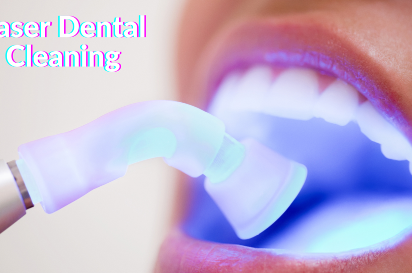 Laser Dental Cleaning